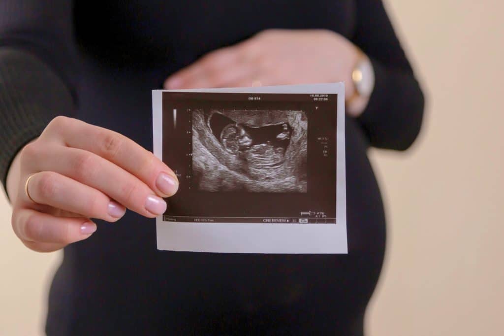 Woman wearing a black long sleeve shirt cradling her baby bump while holding an ultrasound picture.